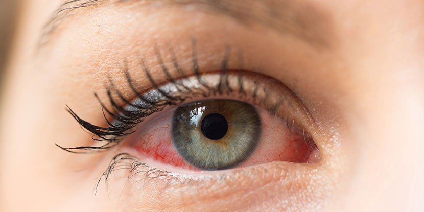 Image Source: Shutterstock